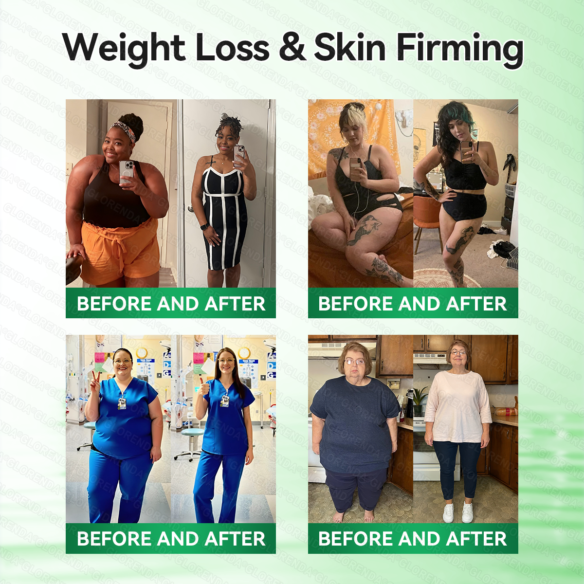𝑶𝒇𝒇𝒊𝒄𝒊𝒂𝒍 𝑺𝒕𝒐𝒓𝒆  | 🧑‍⚕️🧡𝐆𝐋𝐎𝑹𝑬𝑵𝑫𝗔®𝑴𝒐𝒓𝒊𝒏𝒈𝗮 · 𝗕𝗲𝗿𝗯𝗲𝗿𝙞𝙣𝙚 × 𝙉𝘼𝐃+ 𝟏𝟎-𝐢𝐧-𝟏 𝗔𝗱𝘃𝗮𝗻𝗰𝙚𝙙 𝙉𝙖𝙣𝙤 𝙈𝙞𝙘𝙧𝙤𝙣𝙚𝙚𝐝𝐥𝐞 𝐏𝐚𝐭𝙘𝙝🇺🇸(𝐉𝐮𝐬𝐭 𝐨𝐧𝐜𝐞 𝐚 𝐝𝐚𝐲, 𝐯𝐢𝐬𝐢𝐛𝐥𝐞 𝐜𝐡𝐚𝐧𝐠𝐞𝐬 𝐢𝐧 𝟕 𝐝𝐚𝐲𝐬） ✅ 𝐅𝐨𝐫 𝐨𝐛𝐞𝐬𝐢𝐭𝐲, 🅛🅞🅞🅢🅔 🅢🅚🅘🅝,𝐝𝐢𝐚𝐛𝐞𝐭𝐞𝐬, 𝐬𝐥𝐞𝐞𝐩 𝐚𝐩𝐧𝐞𝐚, 𝐣𝐨𝐢𝐧𝐭 𝐢𝐬𝐬𝐮𝐞𝐬, 𝐚𝐧𝐝 𝐦𝐨𝐫𝐞-Z1